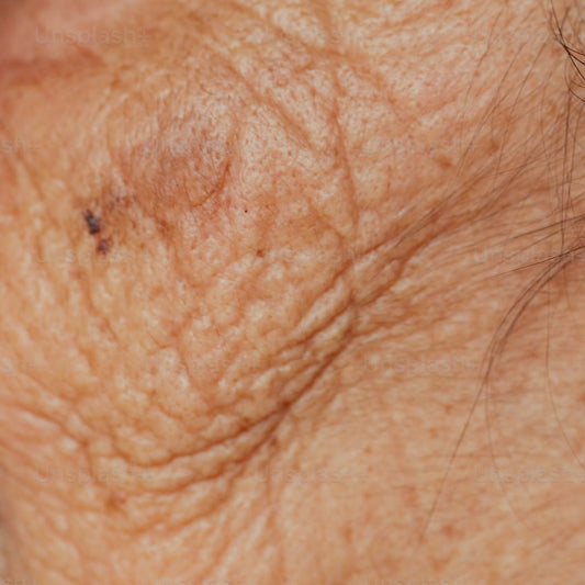 Skin SOS: What is Menopause Skin?