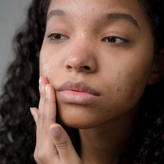 How to Identify and Treat Your Blemishes