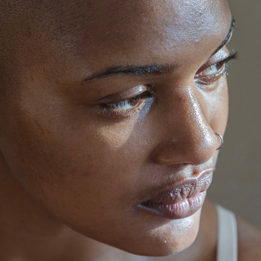 4 Ways to Manage Oily Skin This Summer