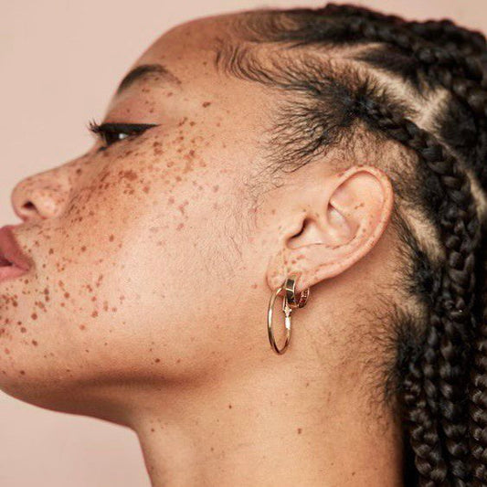 Best Ways to Prevent and Target Sun Spots This Summer