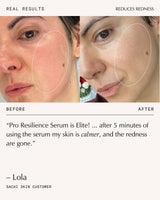 Peptide Pro Resilience® Serum Concentrate Duo