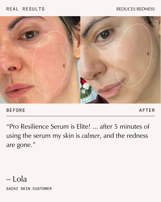 Peptide Pro Resilience® Serum Concentrate - 60ml