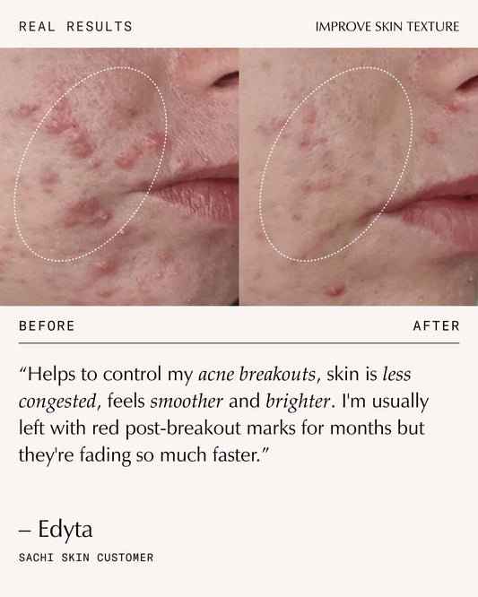 Ursolic Acid & Retinal Overnight Reform - 30ml