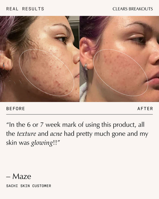 Complexion Clarifying Accelerator - 30ml