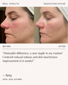 Peptide Pro Resilience® Serum Concentrate - 60ml